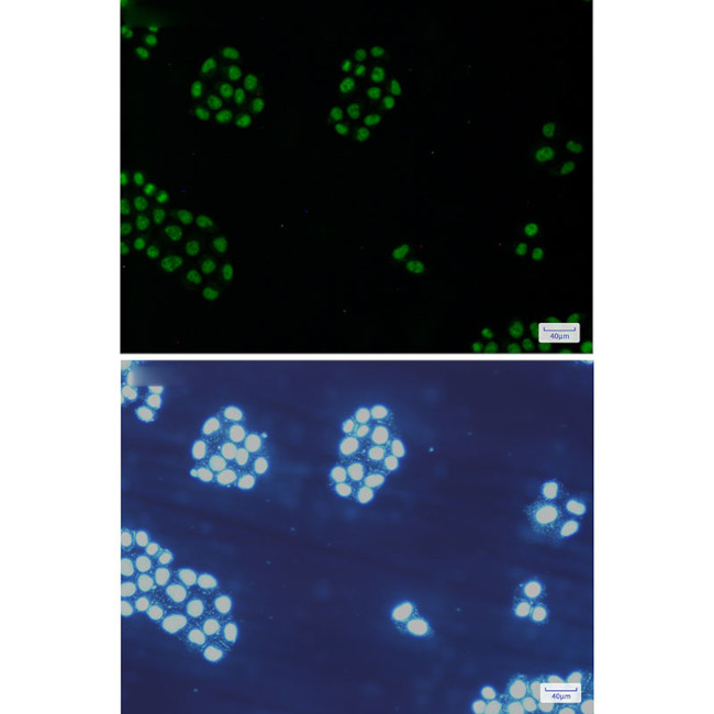 MCM5 Antibody in Immunocytochemistry (ICC/IF)