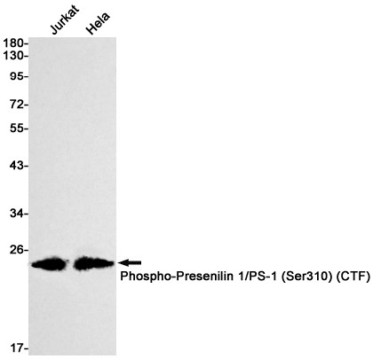 Phospho-Presenilin 1 (Ser310) Antibody in Western Blot (WB)