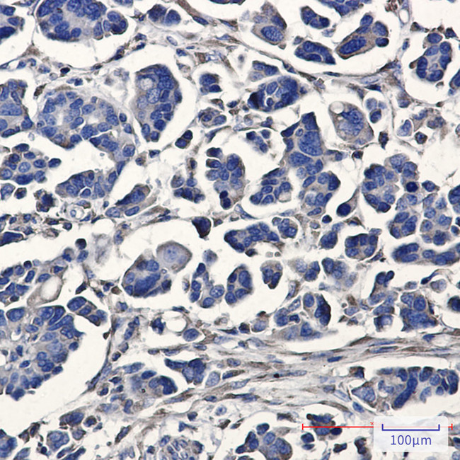 ATE1 Antibody in Immunohistochemistry (Paraffin) (IHC (P))