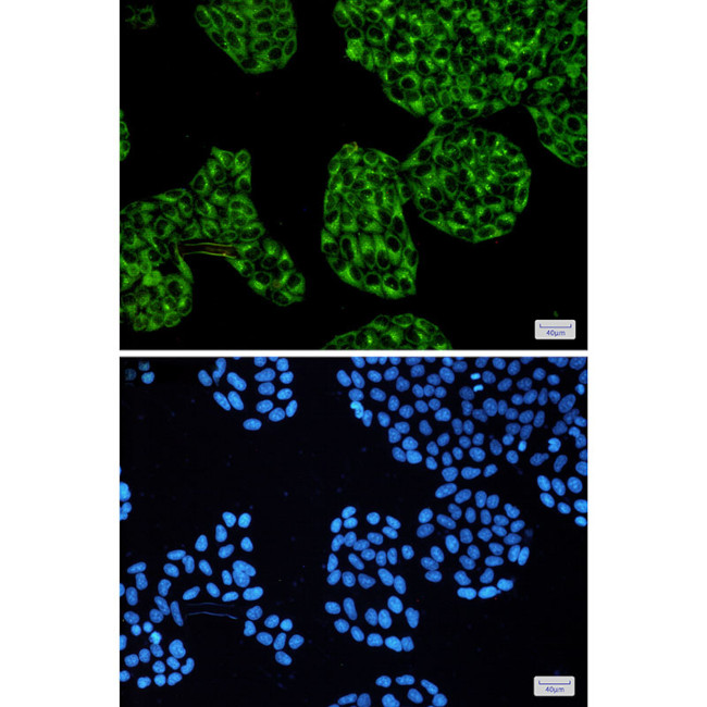 PKA alpha Antibody in Immunocytochemistry (ICC/IF)