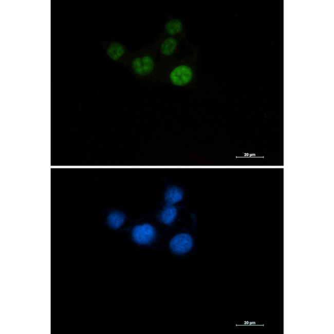 CHK2 Antibody in Immunocytochemistry (ICC/IF)