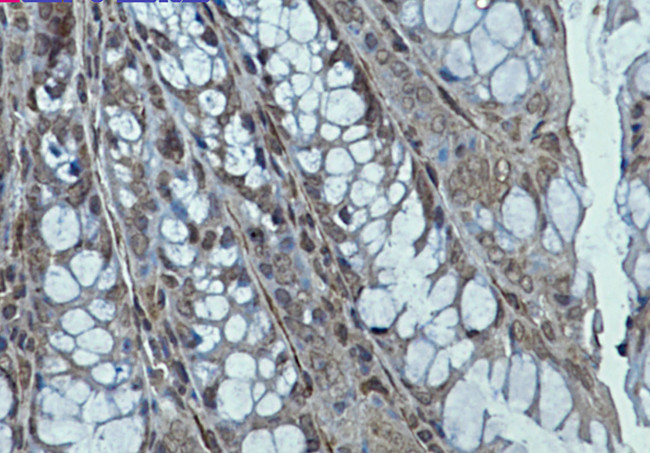 Creatine Kinase BB Antibody in Immunohistochemistry (Paraffin) (IHC (P))
