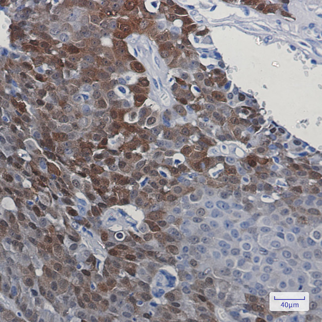 DARPP-32 Antibody in Immunohistochemistry (Paraffin) (IHC (P))