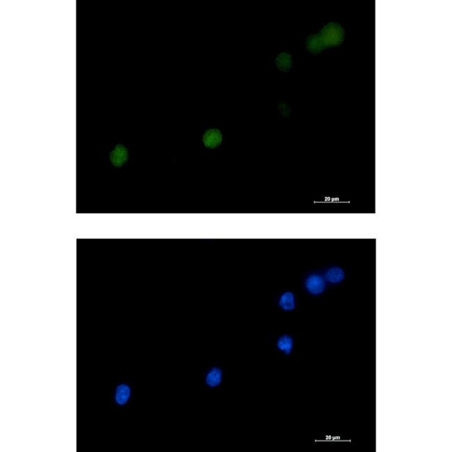 DKC1 Antibody in Immunocytochemistry (ICC/IF)