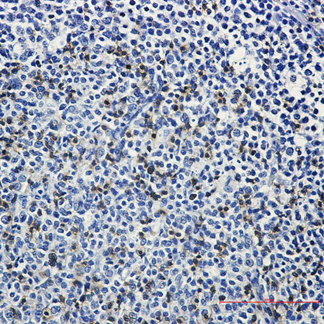 LAT Antibody in Immunohistochemistry (Paraffin) (IHC (P))