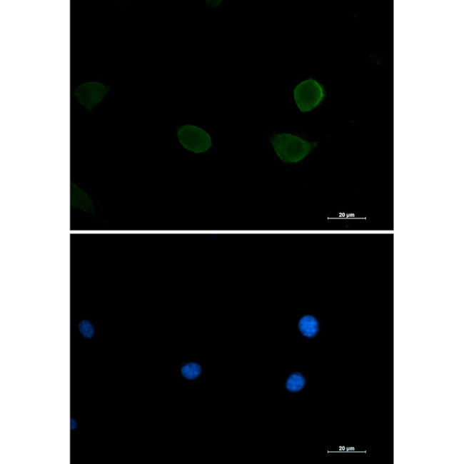 RPS6KB2 Antibody in Immunocytochemistry (ICC/IF)