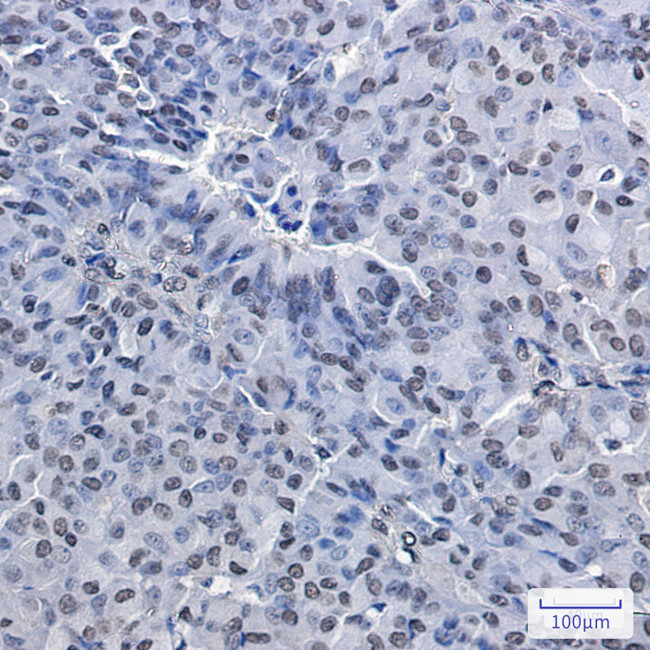PRMT1 Antibody in Immunohistochemistry (Paraffin) (IHC (P))