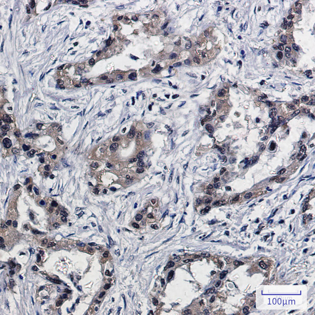 PSMB10 Antibody in Immunohistochemistry (Paraffin) (IHC (P))