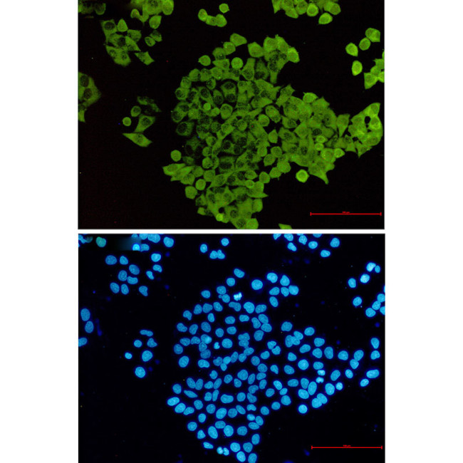 Cofilin Antibody in Immunocytochemistry (ICC/IF)