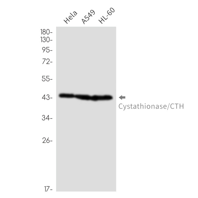 CTH Antibody in Western Blot (WB)