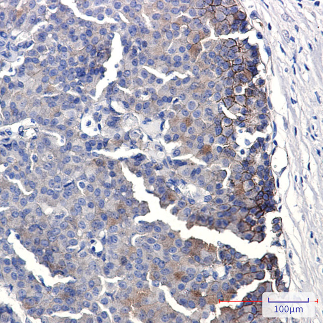EphB4 Antibody in Immunohistochemistry (Paraffin) (IHC (P))
