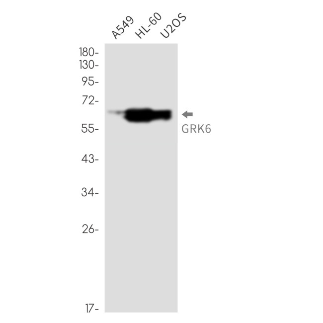 GRK6 Antibody in Western Blot (WB)