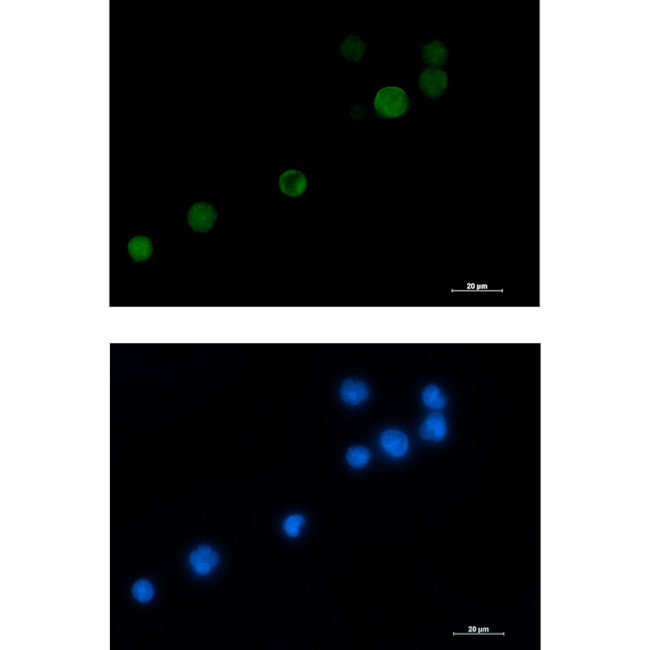 MCAK Antibody in Immunocytochemistry (ICC/IF)