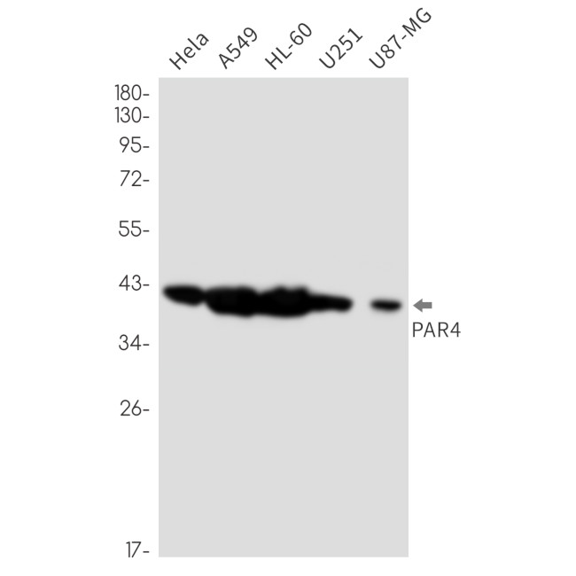 PAR4 Antibody in Western Blot (WB)