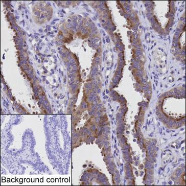 A-Raf Antibody in Immunohistochemistry (Paraffin) (IHC (P))