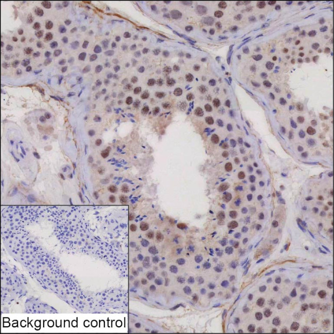 FAM81B Antibody in Immunohistochemistry (Paraffin) (IHC (P))