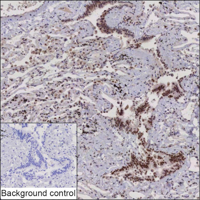 PHF12 Antibody in Immunohistochemistry (Paraffin) (IHC (P))