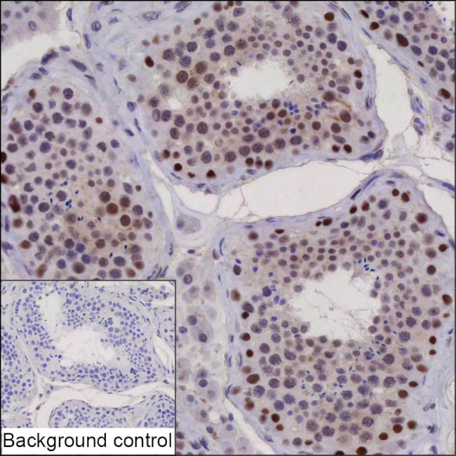 ANKRD26P1 Antibody in Immunohistochemistry (Paraffin) (IHC (P))