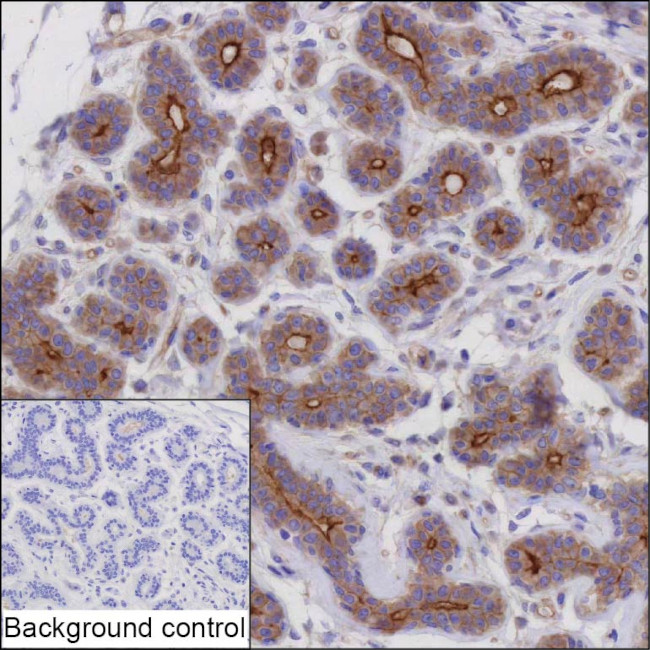 MYO5C Antibody in Immunohistochemistry (Paraffin) (IHC (P))