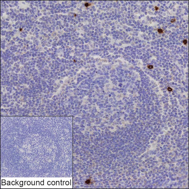 CD122 Antibody in Immunohistochemistry (Paraffin) (IHC (P))