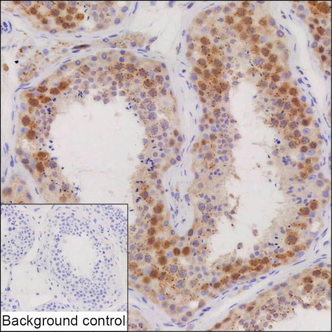 TEX11 Antibody in Immunohistochemistry (Paraffin) (IHC (P))