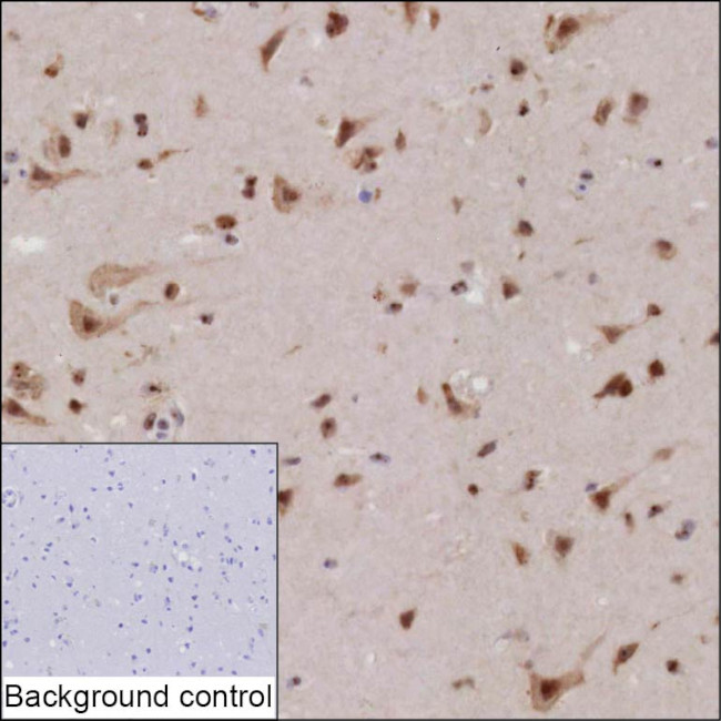 KIAA1755 Antibody in Immunohistochemistry (Paraffin) (IHC (P))
