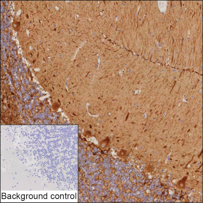 ANKRD20A12P Antibody in Immunohistochemistry (Paraffin) (IHC (P))