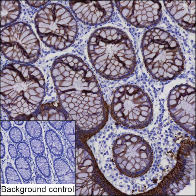 A33 Antibody in Immunohistochemistry (Paraffin) (IHC (P))