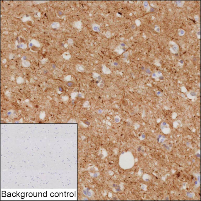 NF-M Antibody in Immunohistochemistry (Paraffin) (IHC (P))