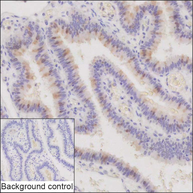 C22orf15 Antibody in Immunohistochemistry (Paraffin) (IHC (P))
