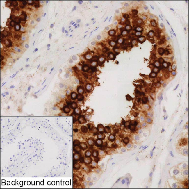 ART3 Antibody in Immunohistochemistry (Paraffin) (IHC (P))