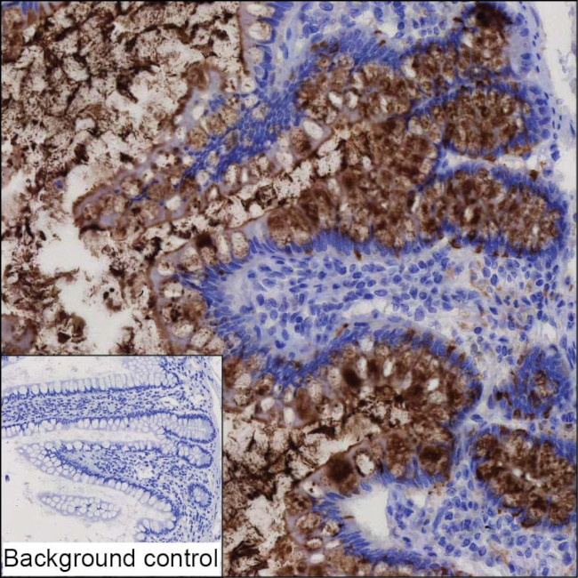 TMPRSS15 Antibody in Immunohistochemistry (Paraffin) (IHC (P))