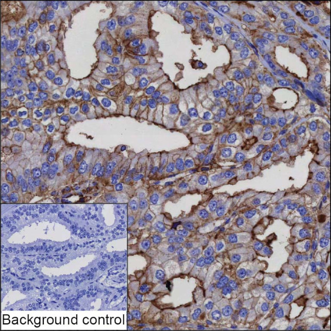 ANKRD55 Antibody in Immunohistochemistry (Paraffin) (IHC (P))