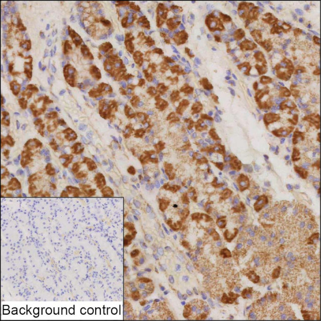 NDUFS4 Antibody in Immunohistochemistry (Paraffin) (IHC (P))