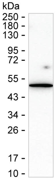 TEM7 Antibody in Western Blot (WB)