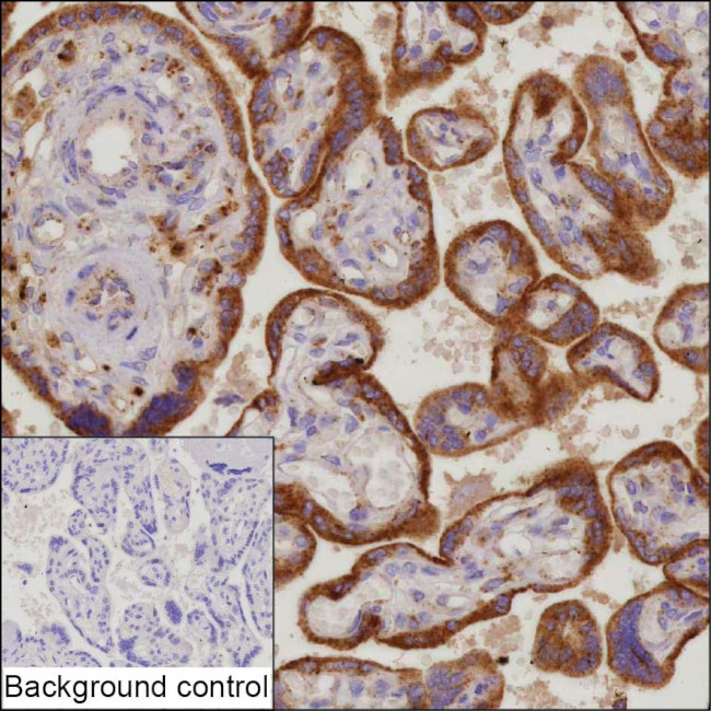 CLN2 Antibody in Immunohistochemistry (Paraffin) (IHC (P))
