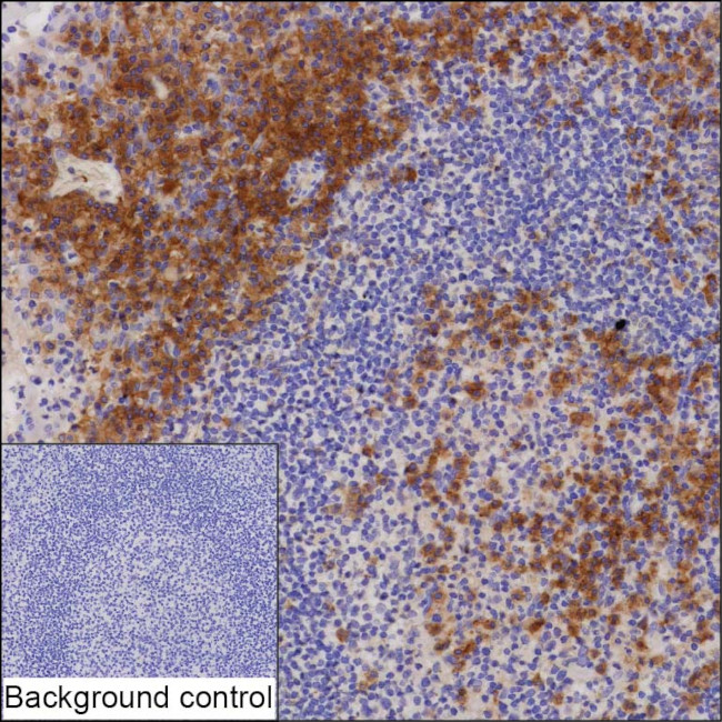 CRACC Antibody in Immunohistochemistry (Paraffin) (IHC (P))