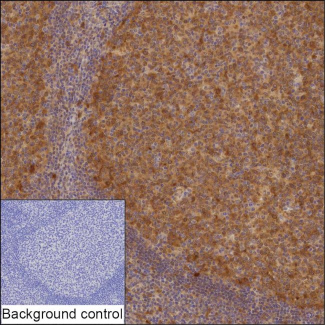 p53R2 Antibody in Immunohistochemistry (Paraffin) (IHC (P))