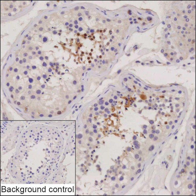TRIML1 Antibody in Immunohistochemistry (Paraffin) (IHC (P))