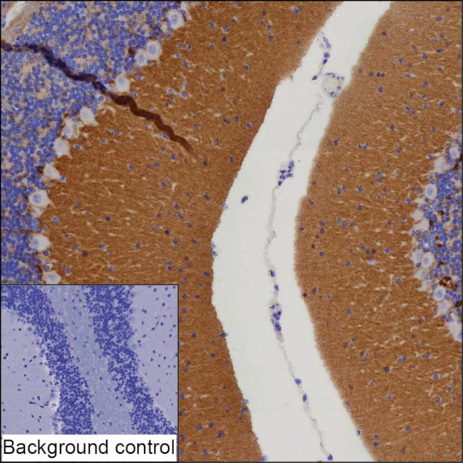 ADAM22 Antibody in Immunohistochemistry (Paraffin) (IHC (P))