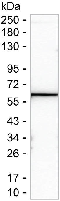 CDC73 Antibody in Western Blot (WB)