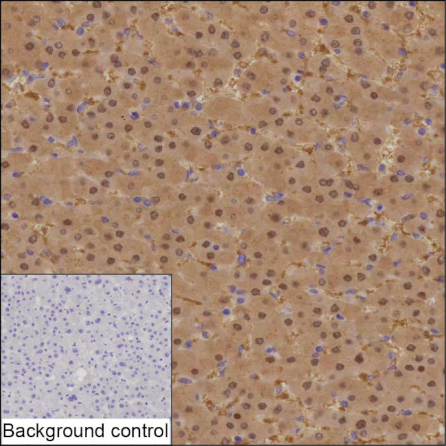 PSMB6 Antibody in Immunohistochemistry (Paraffin) (IHC (P))