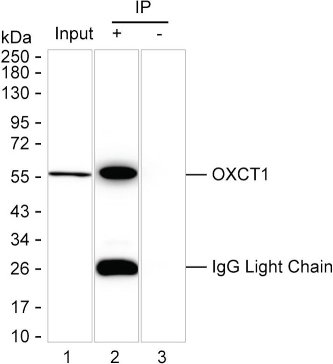 OXCT1 Antibody in Immunoprecipitation (IP)