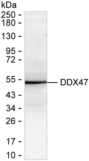 DDX47 Antibody in Western Blot (WB)