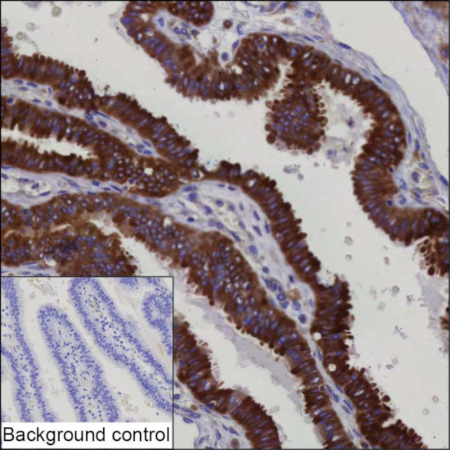 OSBPL11 Antibody in Immunohistochemistry (Paraffin) (IHC (P))