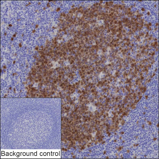 Thymidylate Synthase Antibody in Immunohistochemistry (Paraffin) (IHC (P))