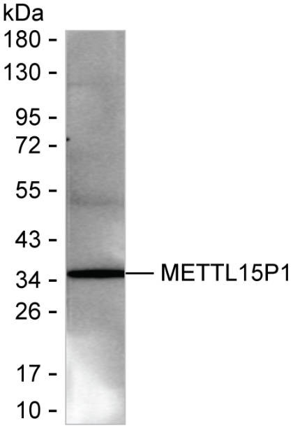METTL15P1 Antibody in Western Blot (WB)