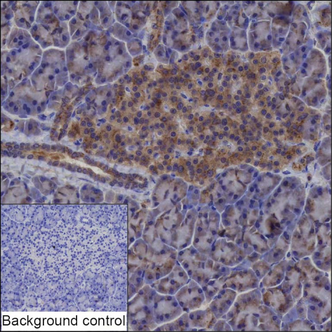 CRELD2 Antibody in Immunohistochemistry (Paraffin) (IHC (P))