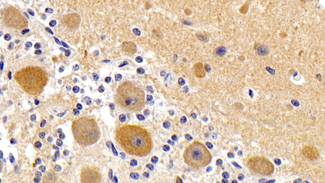 LC3A Antibody in Immunohistochemistry (Paraffin) (IHC (P))