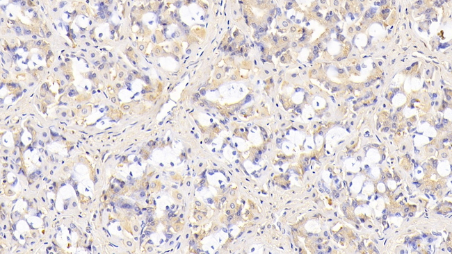 SIRT3 Antibody in Immunohistochemistry (Paraffin) (IHC (P))